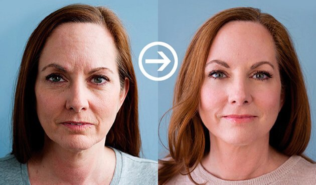 goji crteme ervaringen